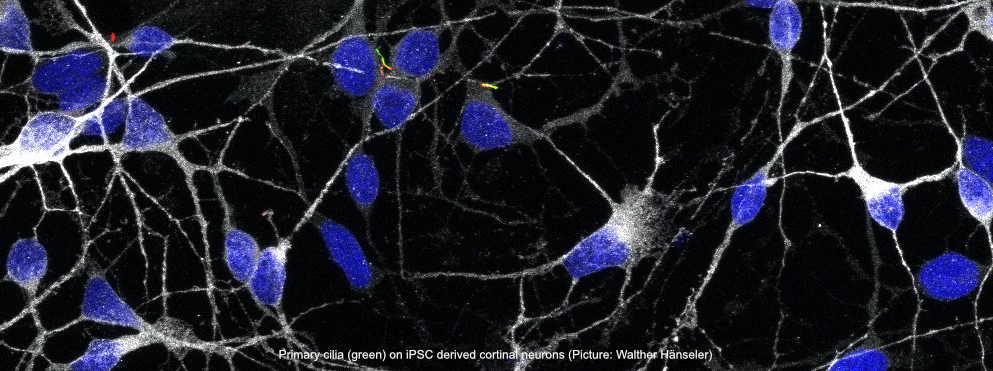 Primary Cilia on iPSC derived cortical neurons