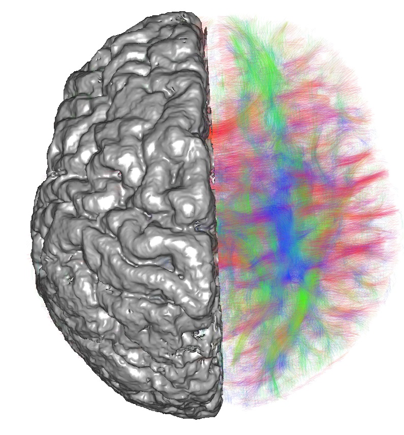 Visualization of neuronal networks in the human brain (Andras Jakab)