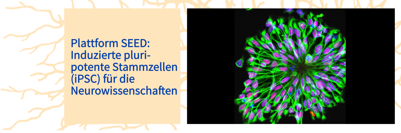 iPSC_de