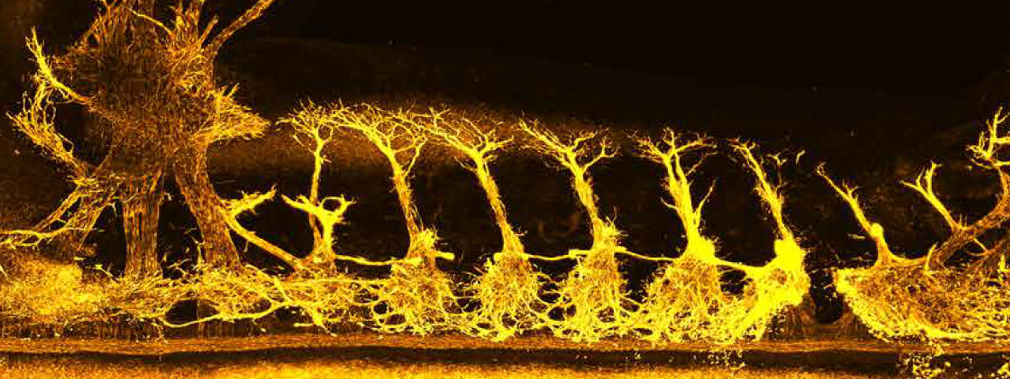 Chick embryo imaged with mesoSPIM